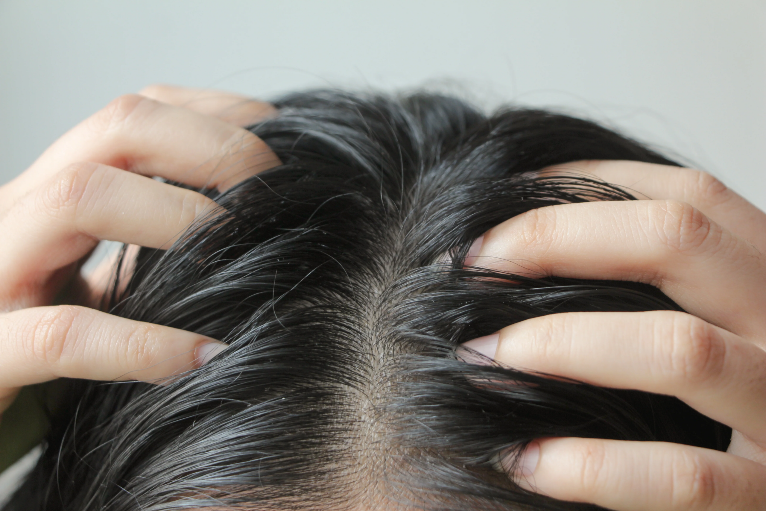 Product buildup in hair